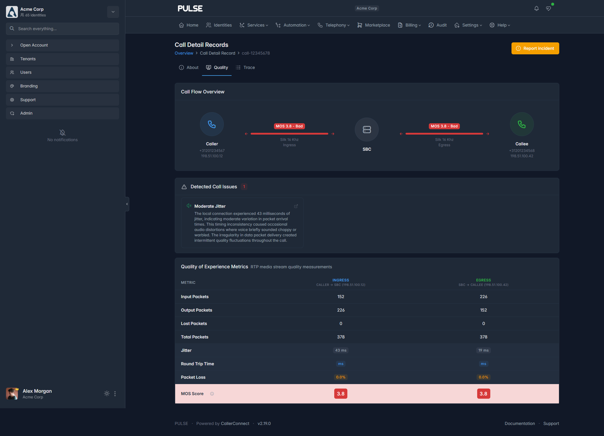 Call Detail Record quality view with MOS, jitter, packet loss and automatic issue detection